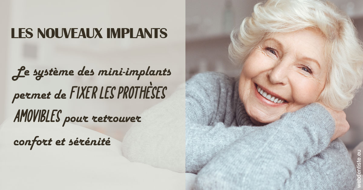 https://dr-pissis-patrick.chirurgiens-dentistes.fr/Les nouveaux implants 1