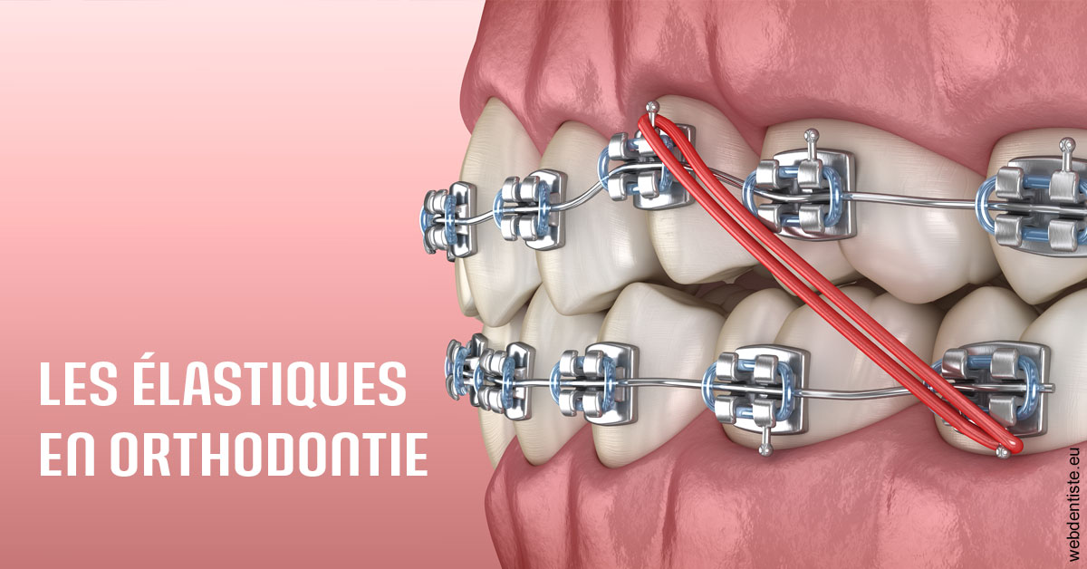 https://dr-pissis-patrick.chirurgiens-dentistes.fr/Elastiques orthodontie 2