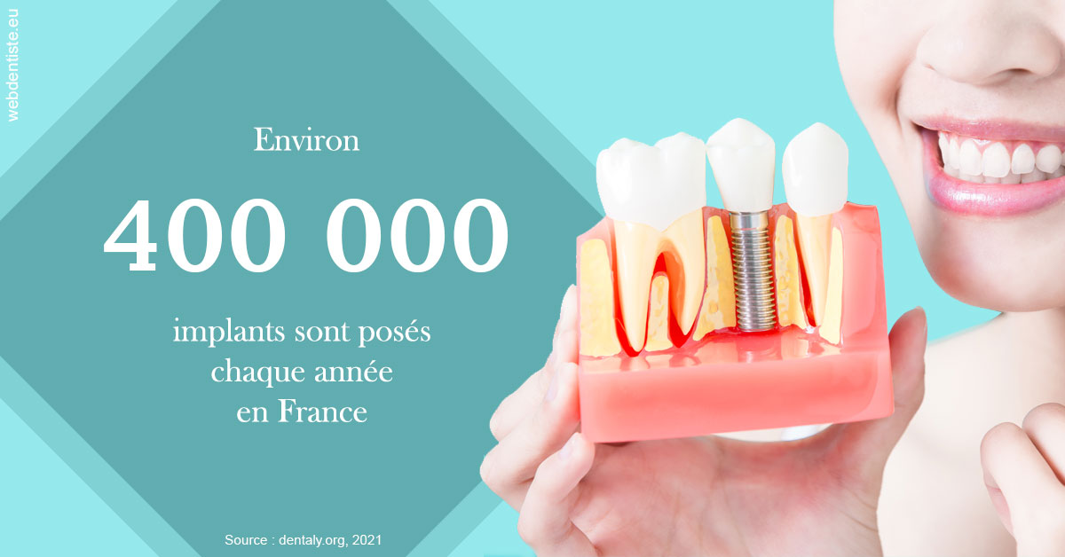 https://dr-pissis-patrick.chirurgiens-dentistes.fr/Pose d'implants en France 2