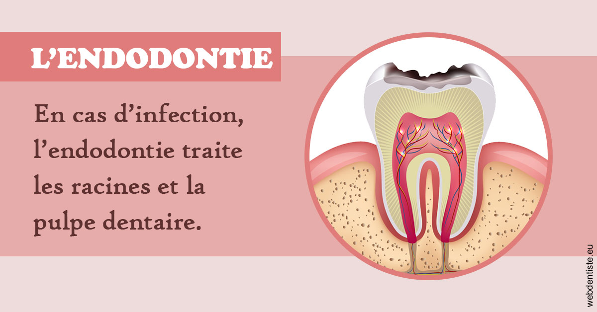 https://dr-pissis-patrick.chirurgiens-dentistes.fr/L'endodontie 2